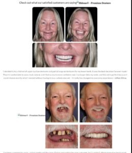 Hidone® Denture Set review 